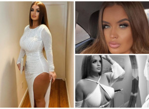 POSTALA JE MILIONERKA SA 17 GODINA A ONDA SPISKALA NOVAC NA SILIKONE: Lepotica jedva ostala živa nakon operacije u Turskoj, evo kako sada izgleda (FOTO)