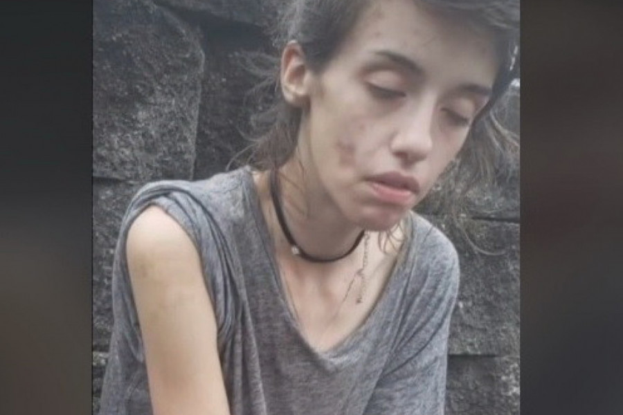 MUZIČARKA JE ZAVRŠILA U PAKLU DROGE, A ONDA SE DOGODILO ČUDO: Danas je neprepoznatljiva, kada se pojavi na ulici svi se za njom okreću! (VIDEO)