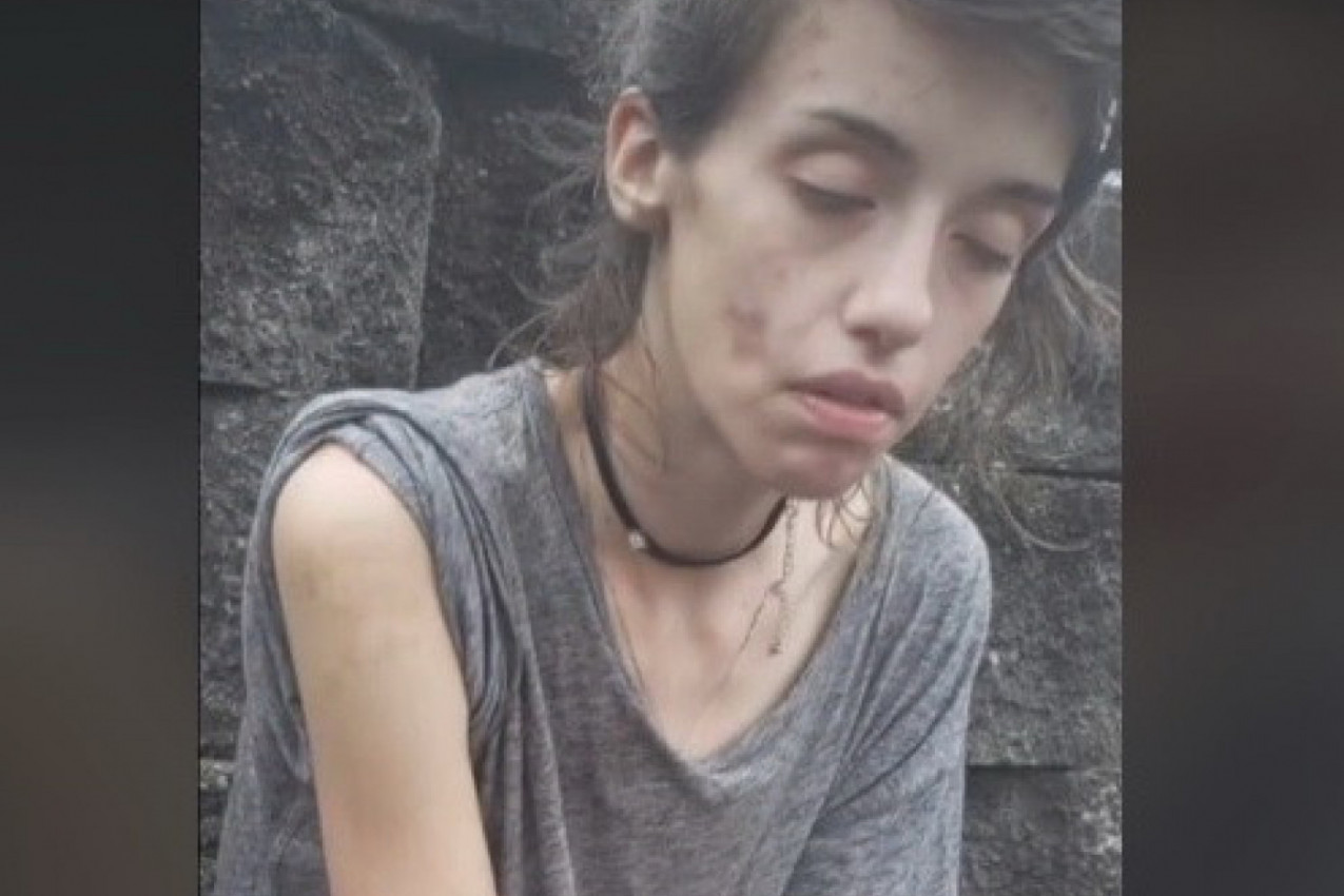 MUZIČARKA JE ZAVRŠILA U PAKLU DROGE, A ONDA SE DOGODILO ČUDO: Danas je neprepoznatljiva, kada se pojavi na ulici svi se za njom okreću! (VIDEO)