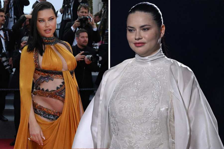 JAVNOST ŠOKIRANA IZGLEDOM ADRIANE LIME: Smatrali su je jednom od najlepših žena sveta a sada je na stubu srama (FOTO)