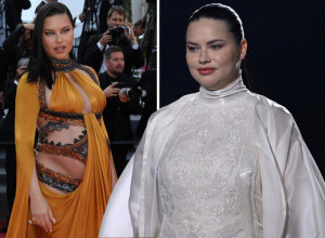 JAVNOST ŠOKIRANA IZGLEDOM ADRIANE LIME: Smatrali su je jednom od najlepših žena sveta a sada je na stubu srama (FOTO)