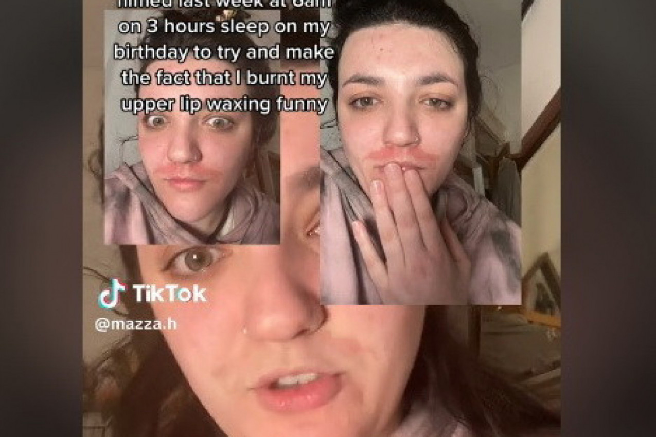 SAMA JE IZDEPILIRALA NAUSNICE, A SADA NE SME DA IZAĐE NA ULICU: Pakao koji je napravila izazvao šok na mrežama! (VIDEO)