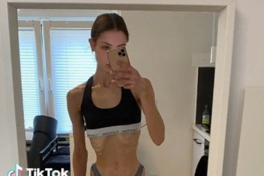 ONA JE DEVOJKA ANĐEOSKOG LIKA, ALI KAD SE POGLEDA NJENO TELO USLEDI ŠOK: Kroz kožu su joj se videle kosti, a onda se odlučila na radikalan potez! (VIDEO)