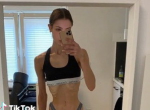 ONA JE DEVOJKA ANĐEOSKOG LIKA, ALI KAD SE POGLEDA NJENO TELO USLEDI ŠOK: Kroz kožu su joj se videle kosti, a onda se odlučila na radikalan potez! (VIDEO)