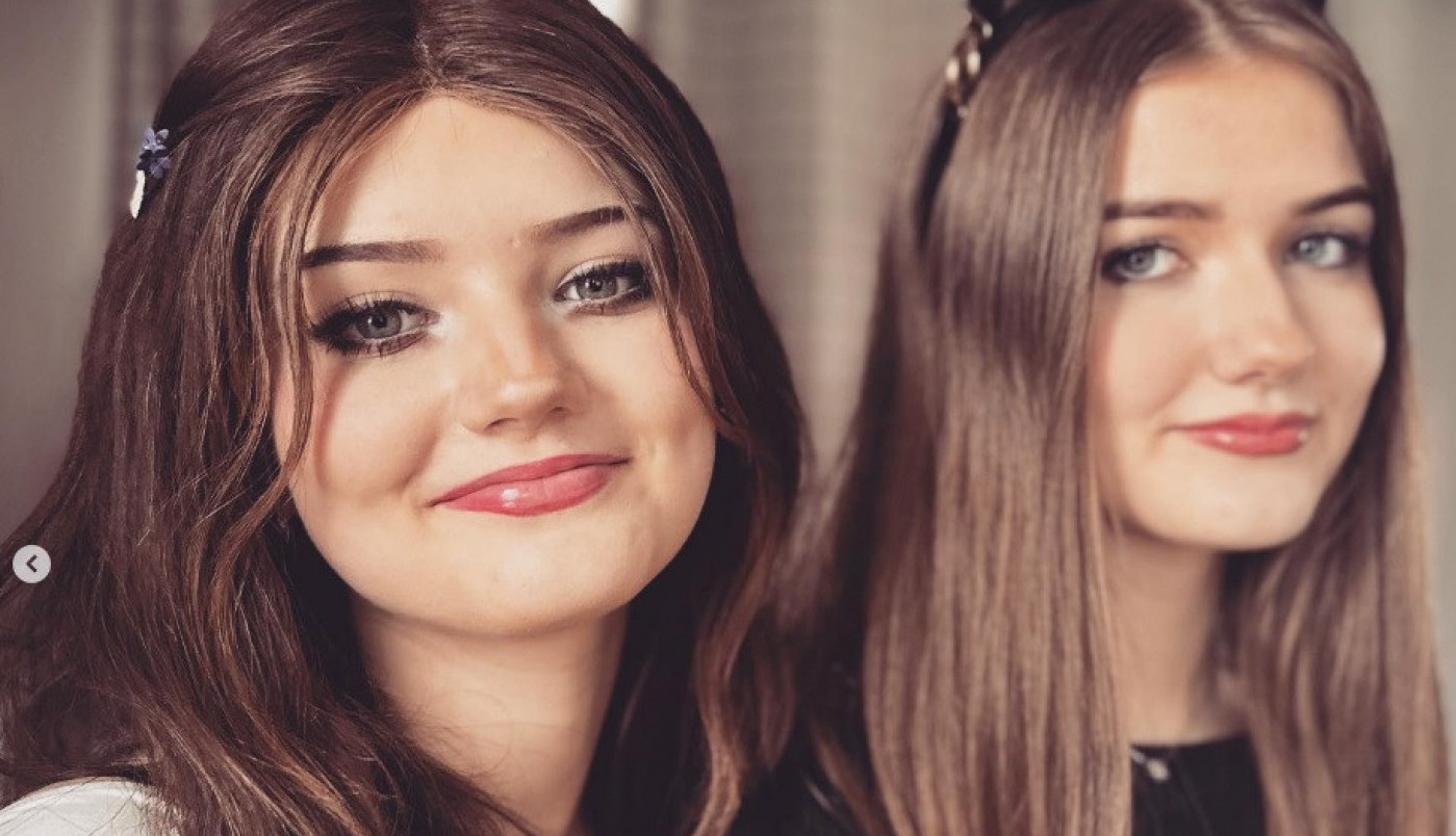 SOFI SE RAZBOLELA OD OPAKE BOLESTI, ALI JE PREKO NOĆI SVE POSTALO BIZARNO: Ono što se dogodilo njenoj sestri bliznakinji sve je zaprepastilo, LEKARI ZANEMELI! (FOTO)