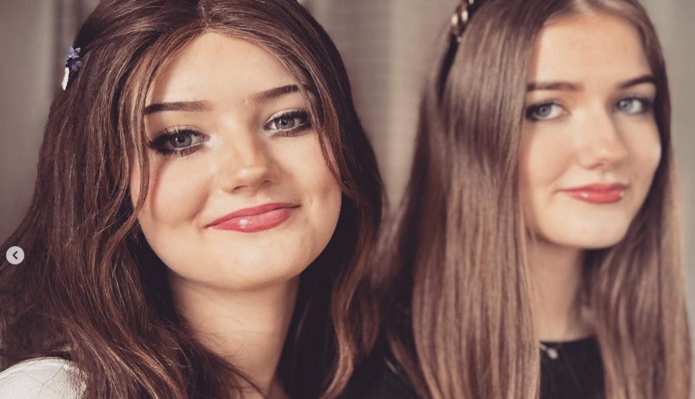 SOFI SE RAZBOLELA OD OPAKE BOLESTI, ALI JE PREKO NOĆI SVE POSTALO BIZARNO: Ono što se dogodilo njenoj sestri bliznakinji sve je zaprepastilo, LEKARI ZANEMELI! (FOTO)