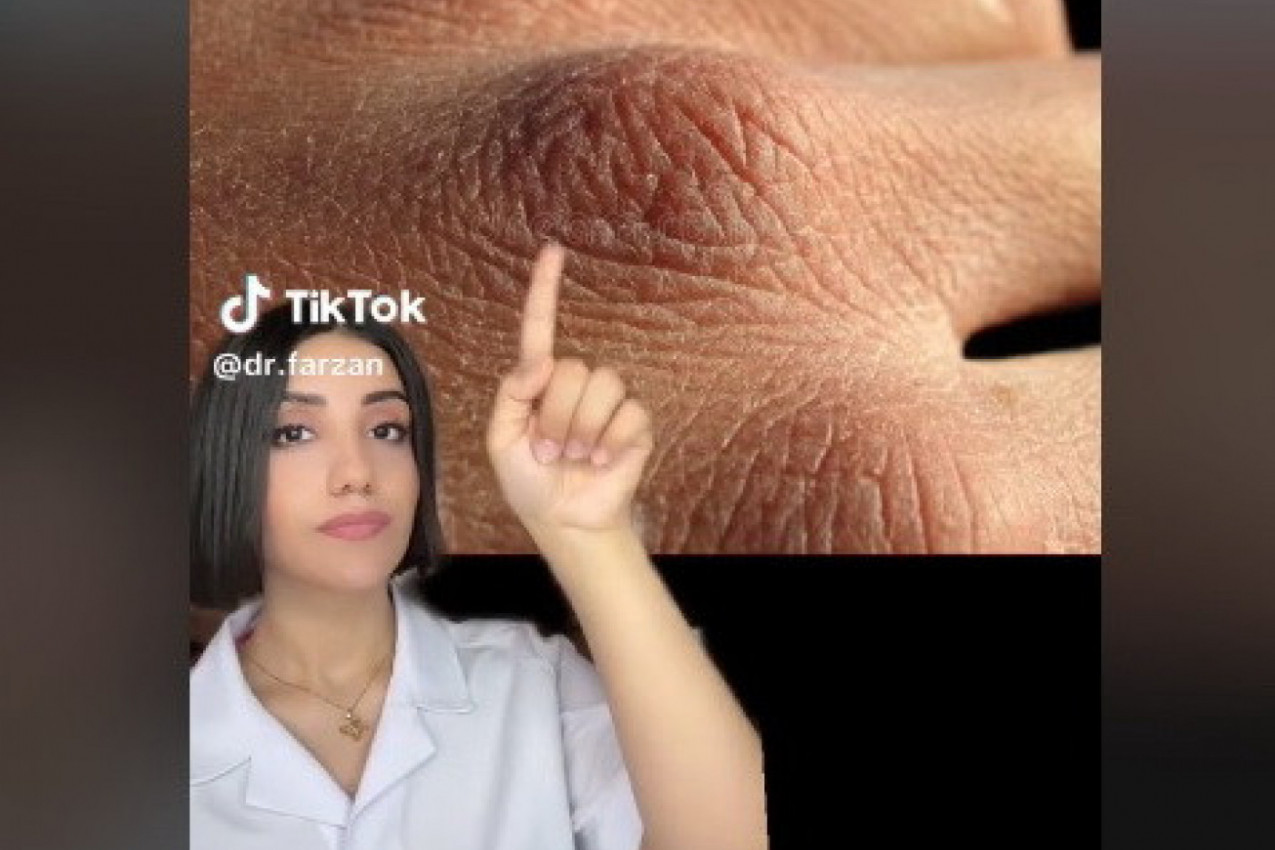 DA LI PREČESTO PERETE RUKE? Možda ćete nakon ovog saznanja prestati to da radite! (VIDEO)