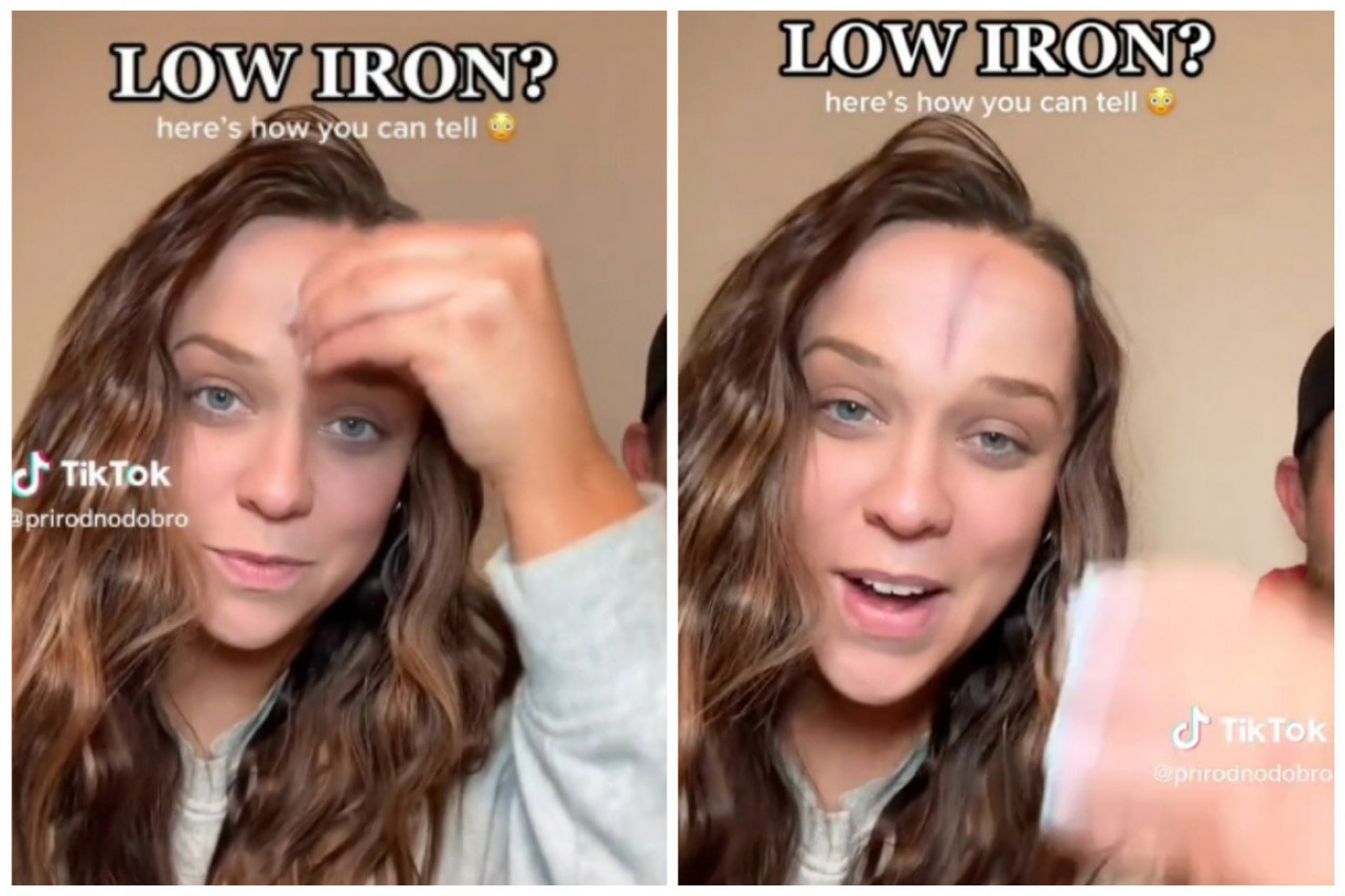 AKO VAM SE OVO POJAVI NA ČELU KAD GA PROTRLJATE PRSTENOM, PRAVAC KOD LEKARA: Neophodna vam je hitna analiza krvi! (FOTO/VIDEO)