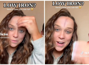 AKO VAM SE OVO POJAVI NA ČELU KAD GA PROTRLJATE PRSTENOM, PRAVAC KOD LEKARA: Neophodna vam je hitna analiza krvi! (FOTO/VIDEO)