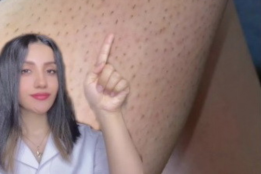 AKO PO NOGAMA IMATE OVO DEFINITIVNO IH POGREŠNO BRIJETE! Evo kako se pravilno uklanjaju dlake! (VIDEO)
