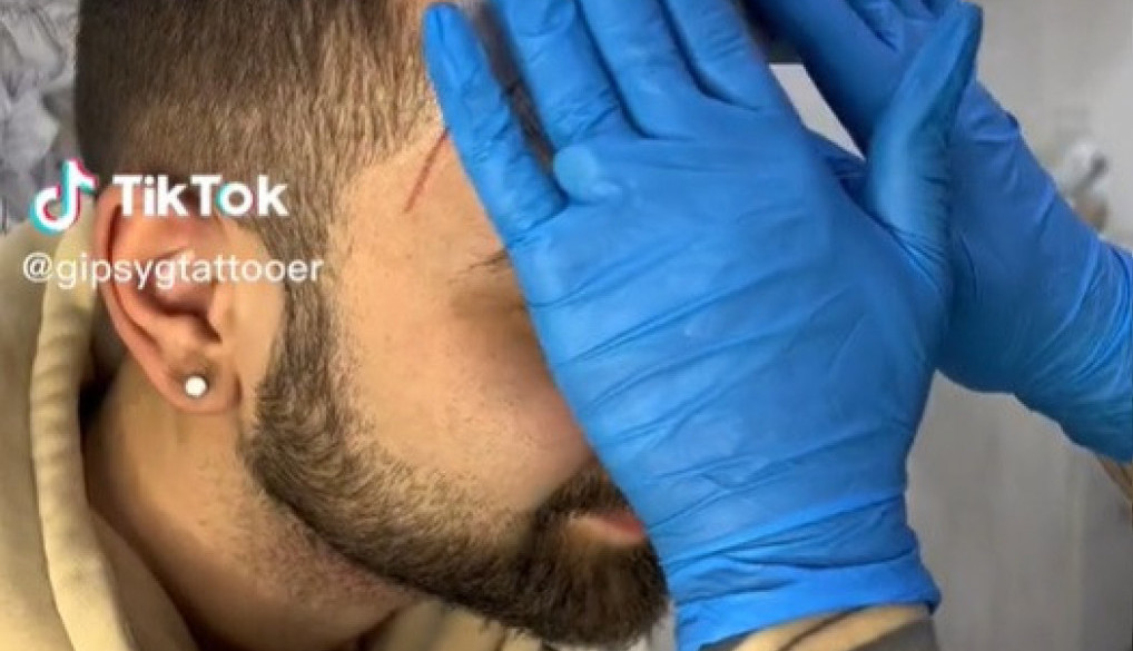 OĆELAVIO JE PA JE ODLUČIO DA ISTETOVIRA ZALISKE I ČELO: Kada je sve bilo gotovo i kada se pogledao u ogledalo vrisnuo je iz sveg glasa, a zatim počeo da rida! (VIDEO)