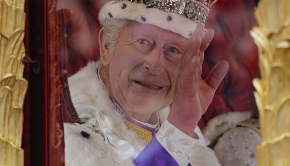 PROGOVORILI LEKARI: Stiglo je konačno objašnjenje zašto kralj Čarls III ima prste kao "kobasice"! (FOTO)