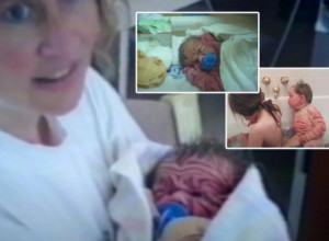 DA LI SE SEĆATE SMEŽURANE BEBE KOJA JE NA ROĐENJU PRESTRAVILA I RODITELJE I LEKARE? Imala je toliko kože da je jedva gledala, šok je tek usledio, a evo GDE JE ONA DANAS! (FOTO/VIDEO)