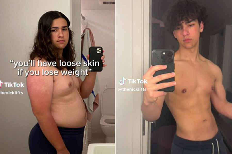 IMAO JE 102 KILOGRAMA SA SAMO 17 GODINA: Tinejdžer je za godinu dana smršao čak 34 kilograma i otkrio jednostavan trik koji svako može da uradi (VIDEO)
