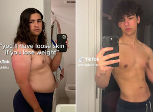 IMAO JE 102 KILOGRAMA SA SAMO 17 GODINA: Tinejdžer je za godinu dana smršao čak 34 kilograma i otkrio jednostavan trik koji svako može da uradi (VIDEO)