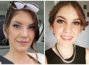 MATEA JE POBEDILA RAK KADA JE IMALA SAMO 10 GODINA, PA ONDA OPET I SA 27: Ovo su joj bili prvi simptomi opake bolesti, a nakon njenog vraćanja pomoglo joj je SAMO JEDNO! (FOTO)