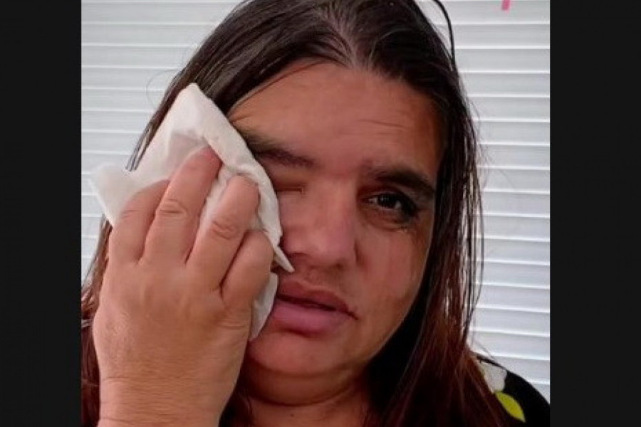 UPLAKANU, ZAPUŠTENU ŽENU MASNE KOSE I NEUREDNOG LICA UVELA JE U SALON: Kada je počela da je šiša i sređuje nije mogla da veruje koga vidi! (VIDEO)