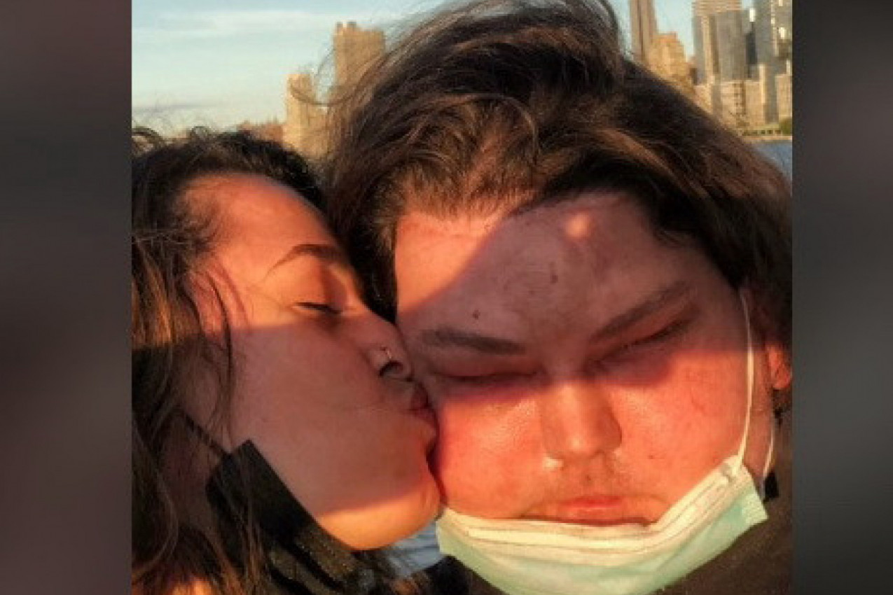 OVO JE MLADIĆ KOME JE PRESAĐENO LICE ČOVEKA OD 47 GODINA i o kom je brujao svet! Sada je objavljeno kako je izgledao pre tragedije, ljudi zanemeli! (VIDEO)