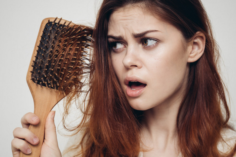 OPADANJE KOSE JE ZNAK ZA UZBUNU: Podmukla bolest krije se iza promena na koje ne obraćamo pažnju, ovo je glavni simptom (FOTO)