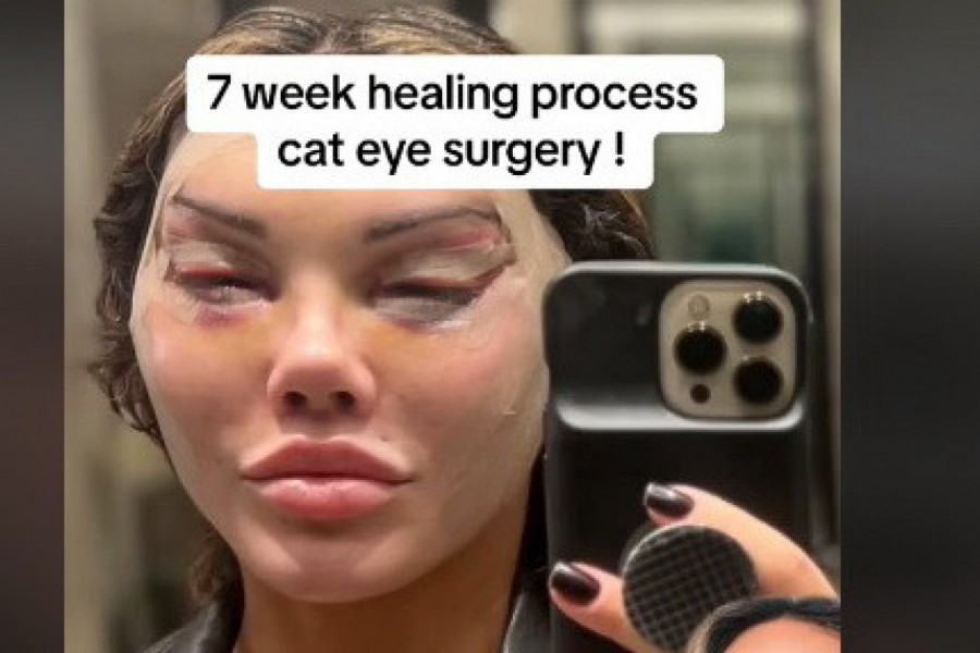 ŽELELA JE MAČIJE OČI, A EVO ŠTA JOJ SE DOGODILO! Sada joj njeni pratioci govore: "Čik skini šminku ako smeš"! (VIDEO)