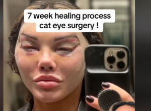 ŽELELA JE MAČIJE OČI, A EVO ŠTA JOJ SE DOGODILO! Sada joj njeni pratioci govore: "Čik skini šminku ako smeš"! (VIDEO)