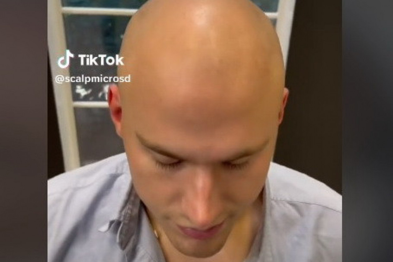 OVAJ MUŠKARAC IMA REŠENJE ZA ĆELAVOST: O njegovom izgledu bruji internet, a evo kako je prikrio problem sa kojim se suočava jači pol (VIDEO)