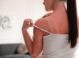 ŽELELI STE PREPLANULI TEN, A ZAVRŠILI U OPEKOTINAMA: Ove 3 maske provereno deluju, a sastojke imaju svi kod kuće!