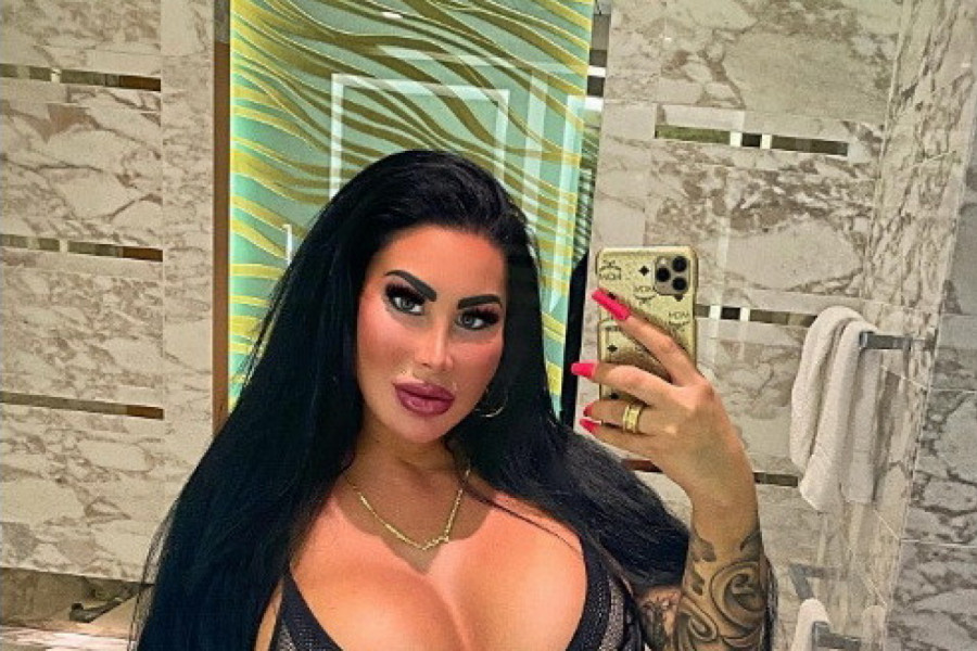 ŠOKANTNA TAJNA SILIKONSKE LEPOTICE: Razlog zbog kojeg je uradila brojne operacije je zastrašujuć, sve je počelo kada je imala 18 godina! (FOTO)