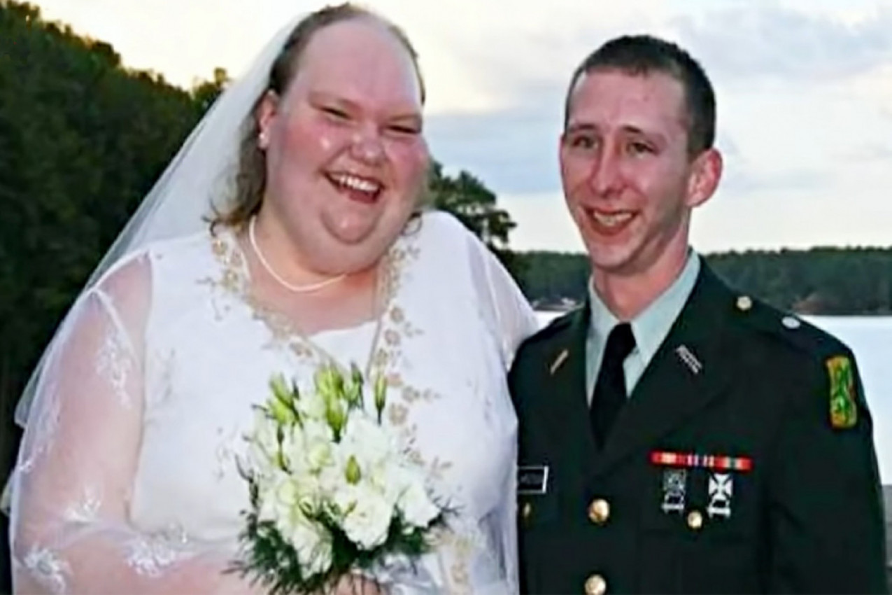 DA LI SE SEĆATE NAJRUŽNIJE MLADE NA SVETU? Postala je predmet ismevanja, ljudi su je nazivali pogrdnim imenima, a danas je doživela TRANSFORMACIJU! (FOTO)