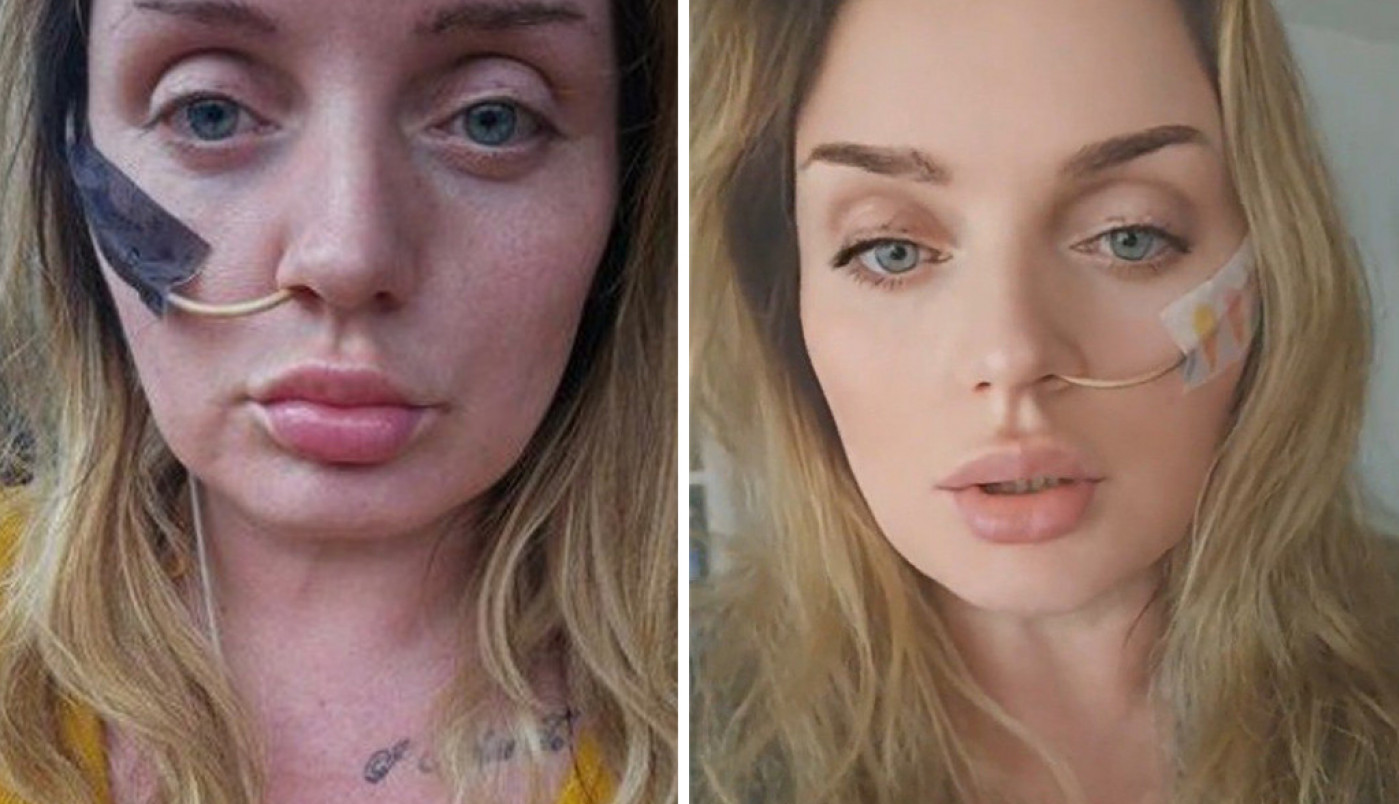 OTIŠLA JE U TURSKU NA JEFTINU OPERACIJU ŽELUCA I JEDVA PREŽIVELA: Danas je vezana za krevet, a priča ove nesrećne žene dovešće vas do suza! (VIDEO)