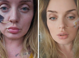 OTIŠLA JE U TURSKU NA JEFTINU OPERACIJU ŽELUCA I JEDVA PREŽIVELA: Danas je vezana za krevet, a priča ove nesrećne žene dovešće vas do suza! (VIDEO)