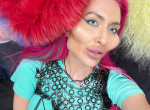 ŽENA SA NAJVEĆIM JAGODICAMA NA SVETU: Anastasija je pokazala kako je izgledala pre operacija i ostavila javnost u neverici (FOTO)