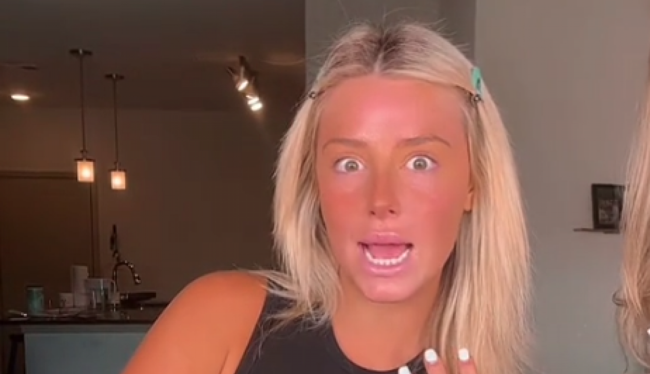 SVESNO JE REŠILA DA PRESKOČI KREMU SA ZAŠTITNIM FAKTOROM I NAMEŽE SE SAMO ULJEM: "Kada sam se vratila sa plaže imala sam šta i da vidim, evo da li je krema bitna!" (FOTO+VIDEO)