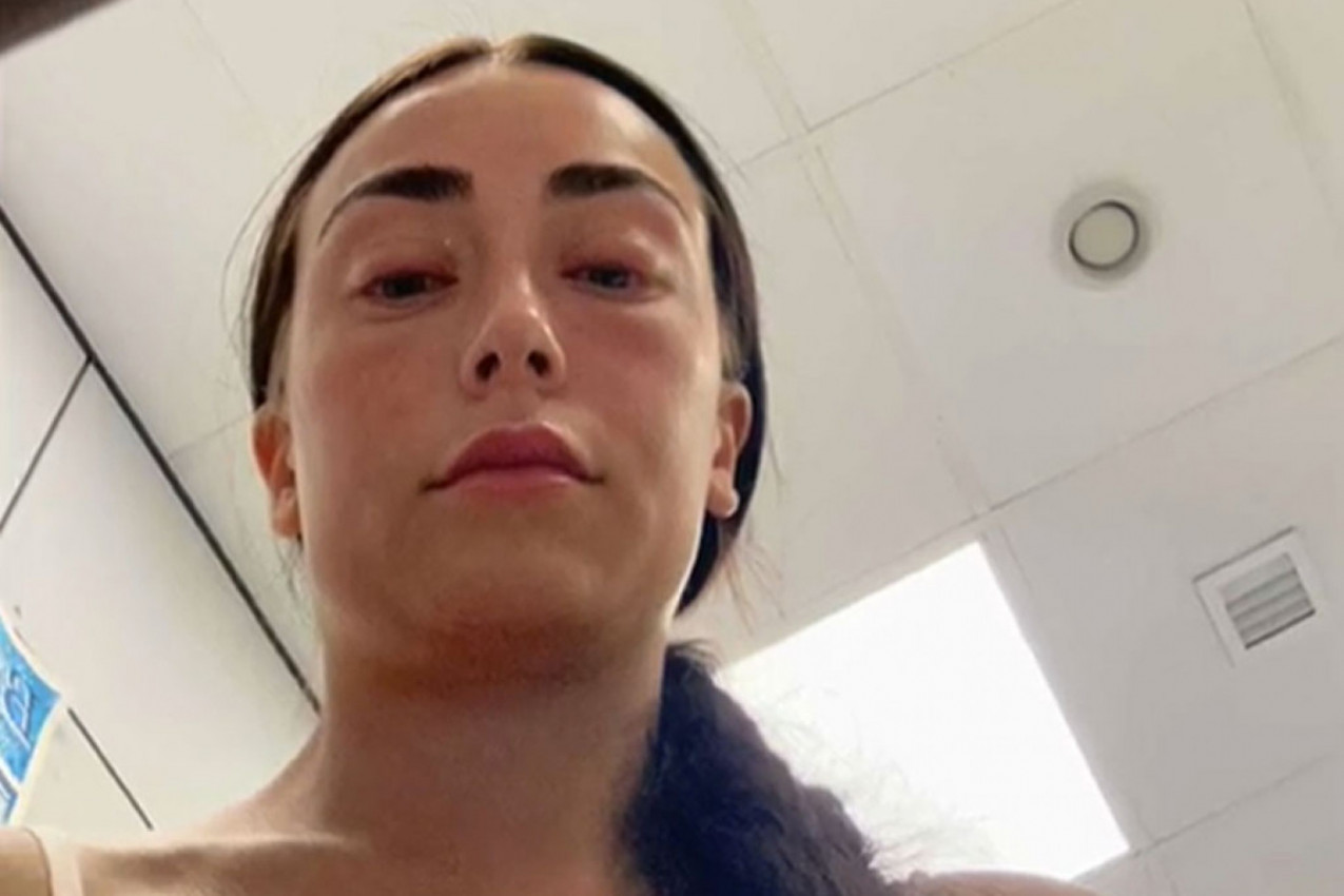 NAKON NADOGRADNJE TREPAVICA ZAVRŠILA U BOLNICI: Devojka otkrila detalje drame koja je trajala danima (VIDEO)