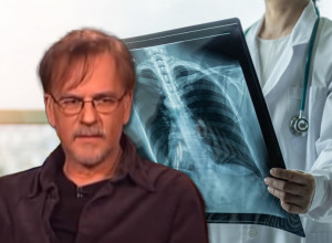 SIMPTOMI RAKA PLUĆA OD KOJEG JE UMRO ŽARKO LAUŠEVIĆ: Ovaj podmukli karcinom kosi po Srbiji, a pušači su u najvećem riziku!