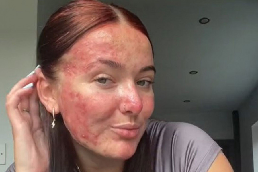 GODINAMA JE PATILA ZBOG SVOG IZGLEDA: Onda je rešila da svetu pokaže pravo lice i usledilo je nešto što nije ni sanjala  (FOTO+VIDEO)