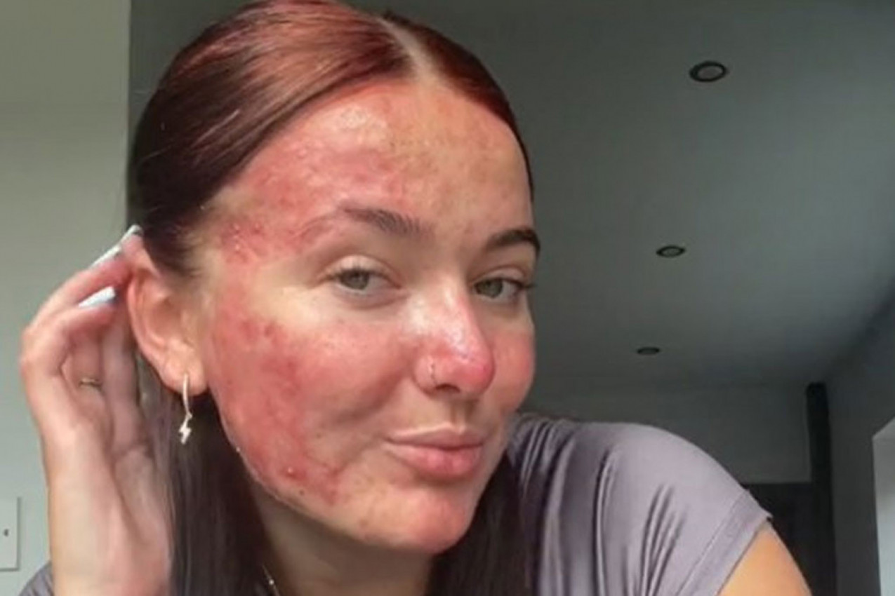 GODINAMA JE PATILA ZBOG SVOG IZGLEDA: Onda je rešila da svetu pokaže pravo lice i usledilo je nešto što nije ni sanjala  (FOTO+VIDEO)