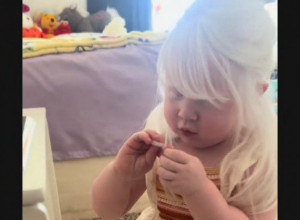 OVA PRESLATKA DEVOJČICA IMA REDAK GENETSKI POREMEĆAJ: Ne igra se napolju, običan sunčan dan za nju može biti poguban(FOTO)