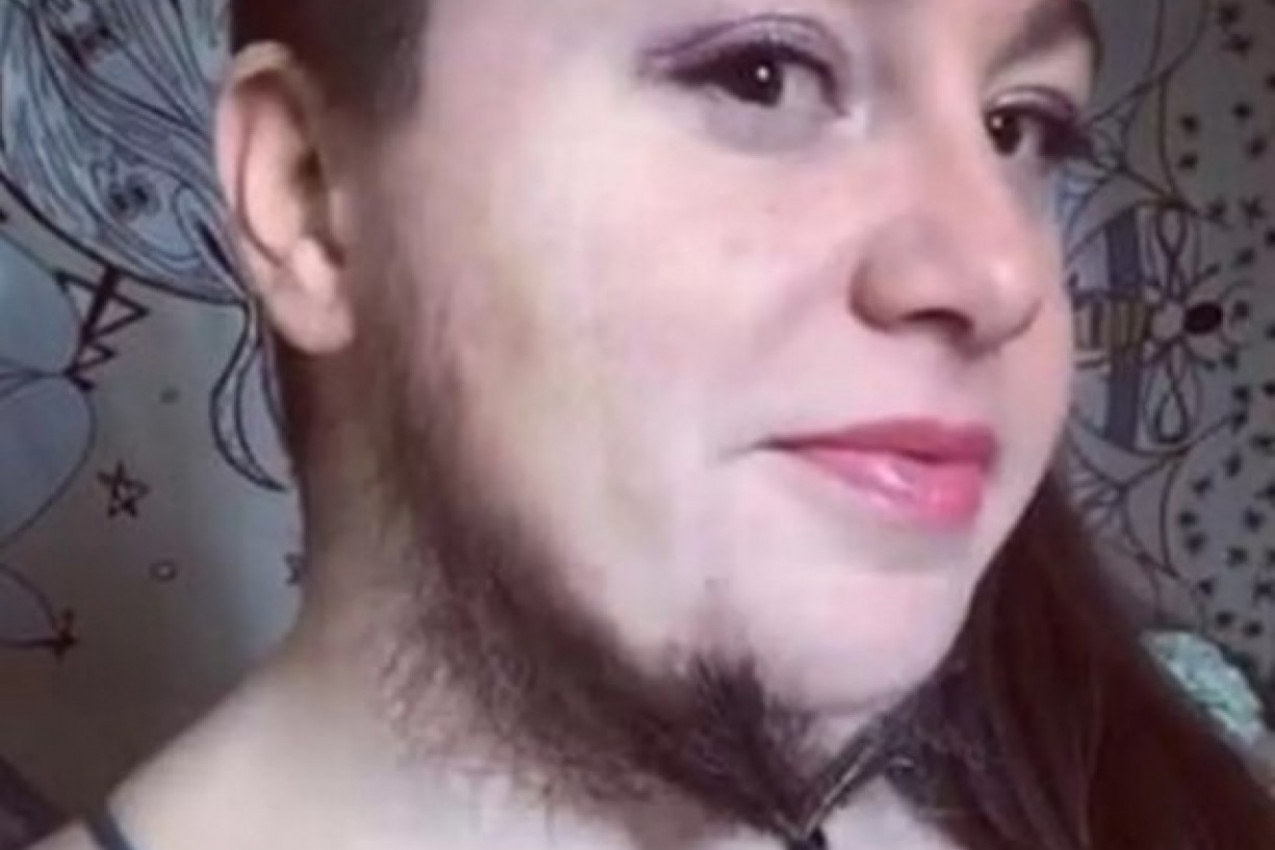 ŽENA SA PLETENICAMA OD BRADE SEBE NAZIVA BOGINJOM: Ova tiktokerka izaziva ogromnu pažnju neobičnim izgledom, a sada je otkrila zbog čega je puštala dlake na licu (VIDEO)