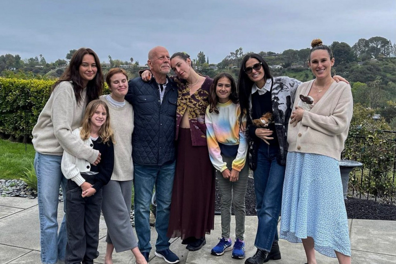 RANI POKAZATELJI RETKE BOLESTI KOJU IMA BRUS VILIS SE PREPOZNAJU PREMA JEDNOM SIMPTOMU: Doktorka objašnjava na koju promenu je bitno da porodica obrati pažnju!