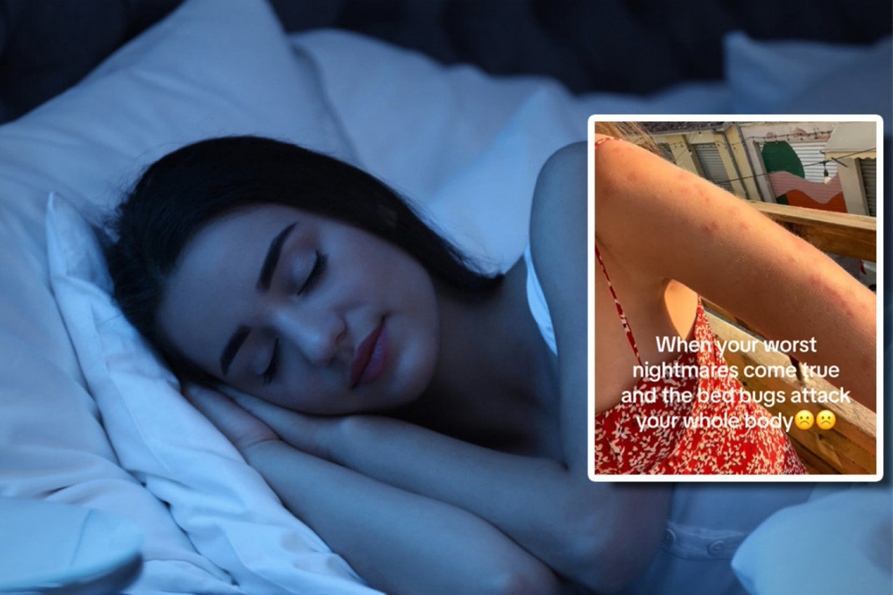 "KADA TI SE OSTVARI NAJGORA NOĆNA MORA: Devojka pokazala izujedano telo, ima strah da uveče legne u krevet i zaspi! (VIDEO)