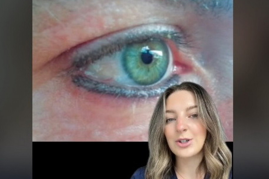 OVU ŠMINKU KORISTIMO SVAKODNEVNO, A MOŽE DA OŠTETI OČI: Oftamolog upozorava na štetnost ove kozmetike za ulepšavanje (VIDEO)