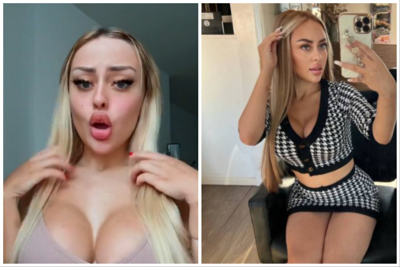 IMA SAMO 19 GODINA I VIŠE OD LITRE BOTOKSA, FILERA NA SEBI: Kada je otkrila ko joj plaća intervencije, svi su zanemeli (VIDEO)