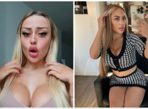 IMA SAMO 19 GODINA I VIŠE OD LITRE BOTOKSA, FILERA NA SEBI: Kada je otkrila ko joj plaća intervencije, svi su zanemeli (VIDEO)