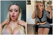 IMA SAMO 19 GODINA I VIŠE OD LITRE BOTOKSA, FILERA NA SEBI: Kada je otkrila ko joj plaća intervencije, svi su zanemeli (VIDEO)