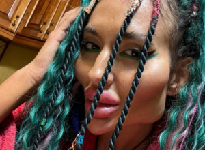 ŽENA SA NAJVEĆIM JAGODICAMA POKAZALA ZASTRAŠUJUĆE REZULTATE NOVE PROCEDURE: Ljudi u neverici gledaju snimak i pitaju je samo jedno (VIDEO)