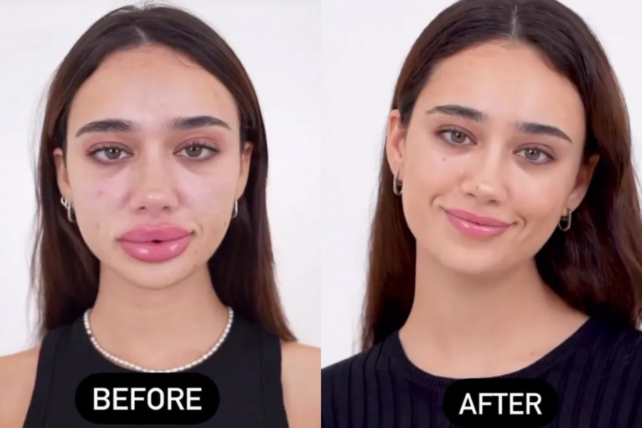 ŠOKIRAĆETE SE KAD ČUJETE KOJA PRIČA SE KRIJA IZA OVE FOTOGRAFIJE: Oglasila se popularna voditeljka i rekla da joj se isto desilo (FOTO)