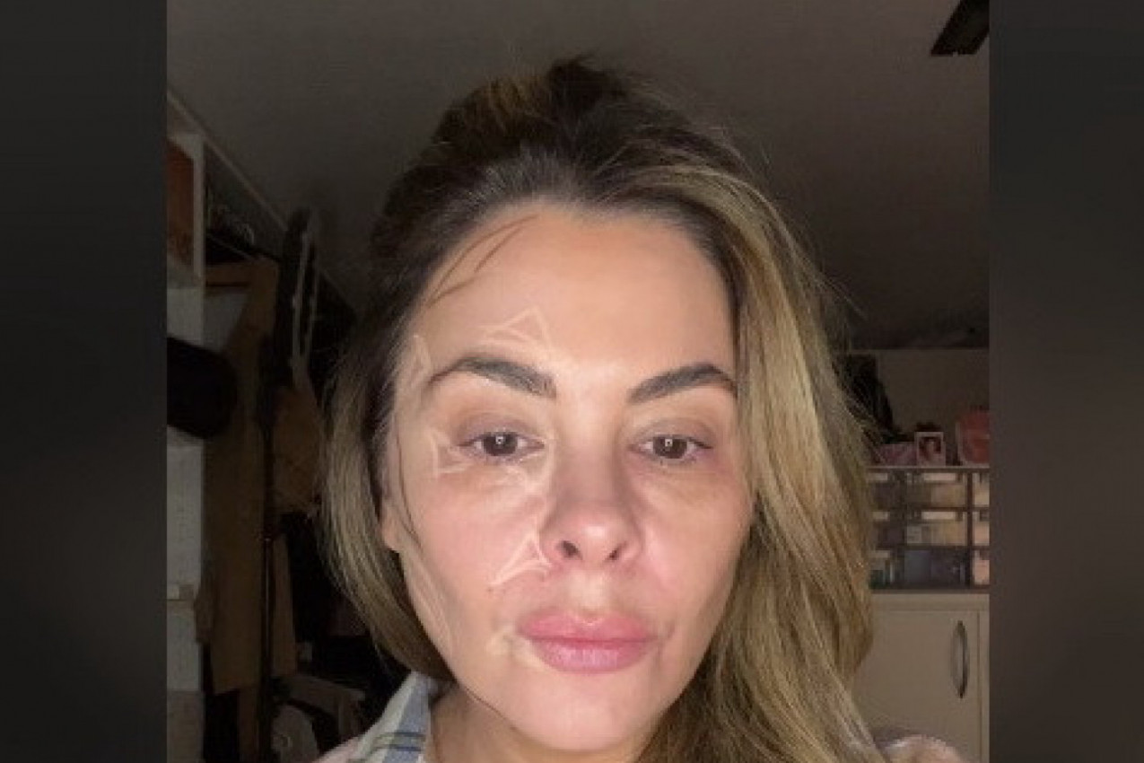 TRIK KOJI BRIŠE GODINE: Evo kako da postignete lifting lica pomoću šminke (VIDEO)