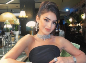 LEPOTICU IZ DUBAIJA MESECIMA SU MUČILE MIGRENE: Posle jednog pregleda lekari su joj saopštili strašnu dijagnozu (VIDEO)