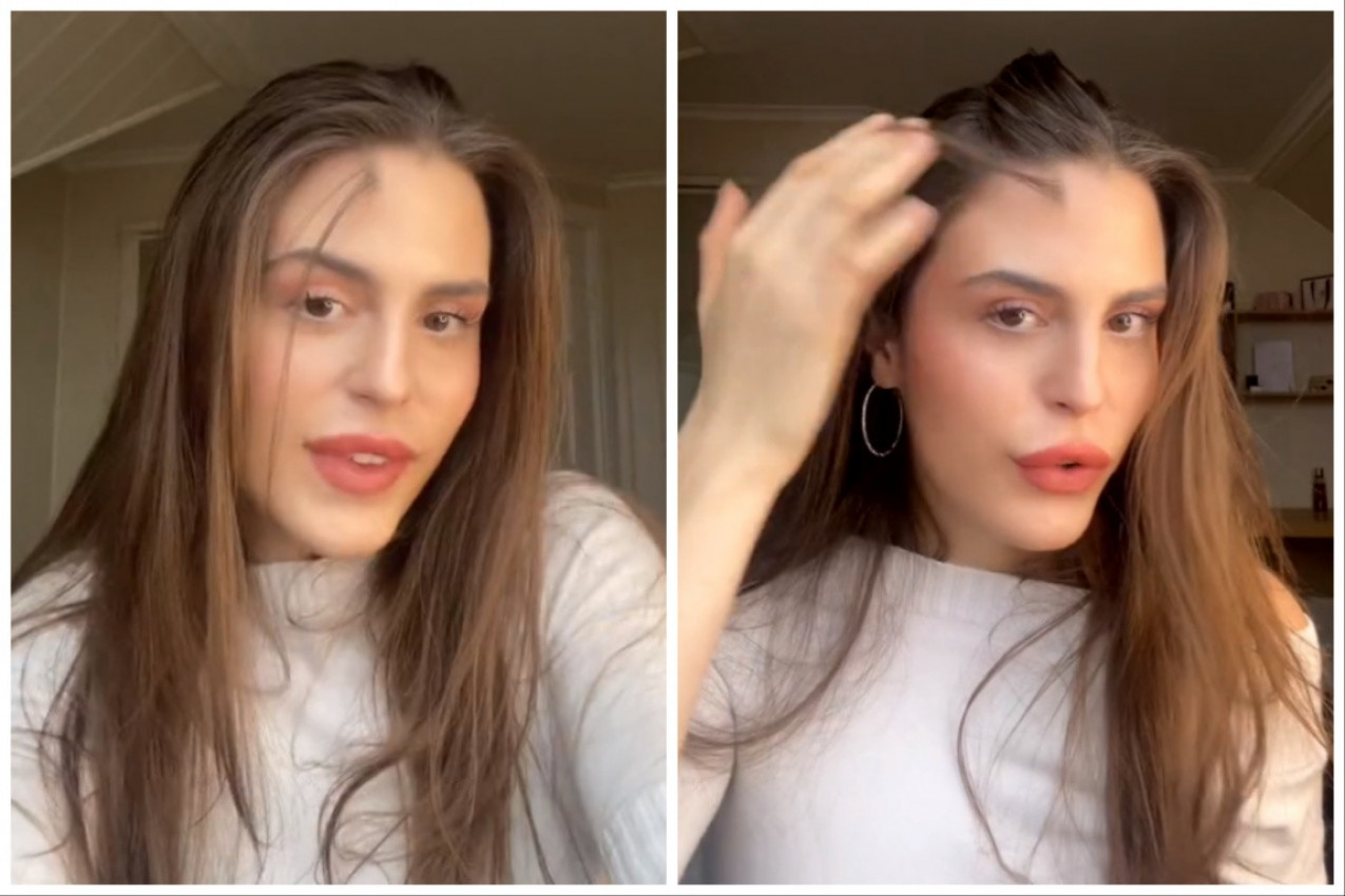 RADA JE POMERILA KOSU I ZAPANJILA PRATIOCE: Lepotica ima pramen na neobičnom mestu, ljudi gledaju u neverici! (FOTO+VIDEO)